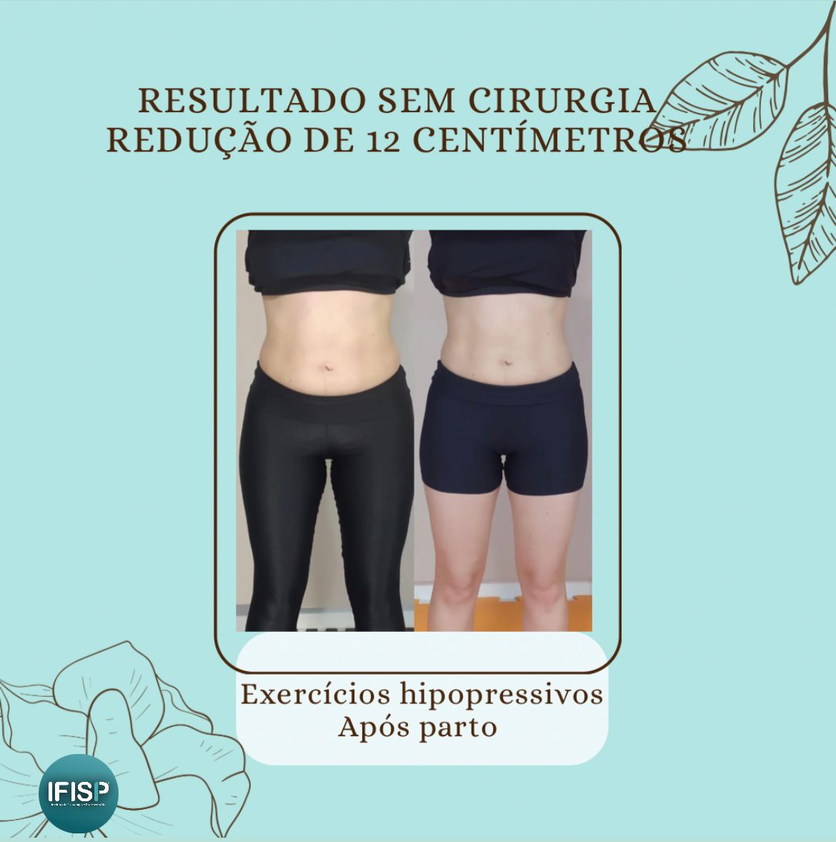 Exercícios hipopressivos após o parto - IFISP Instituto de Fisioterapia ...