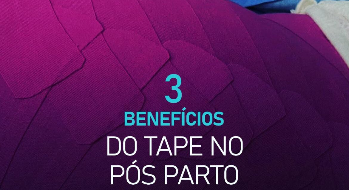 3 benefícios do tape após parto